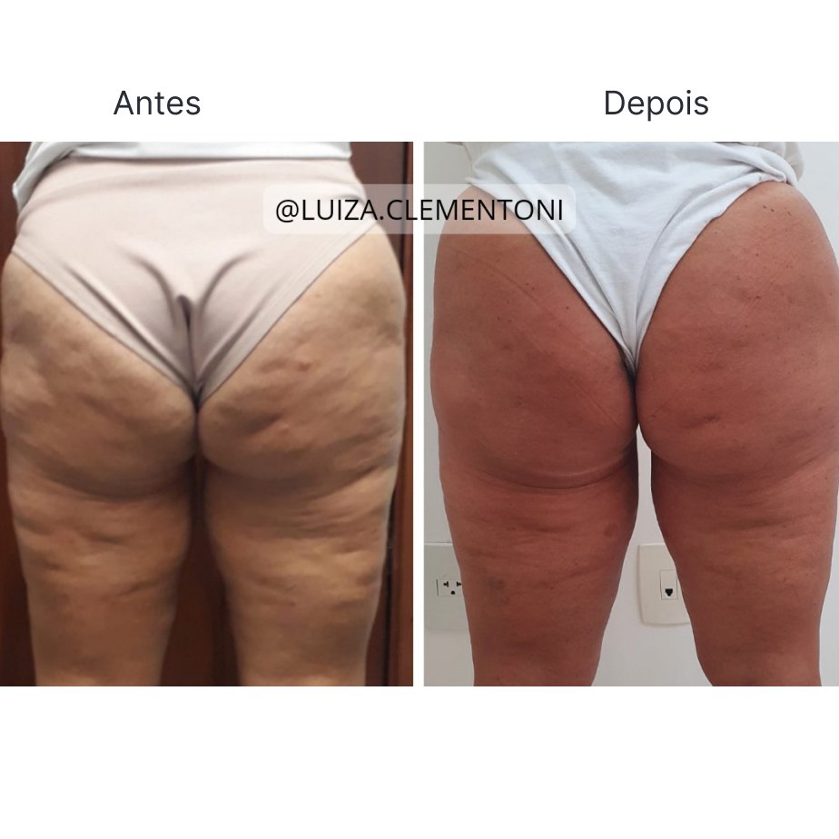Estética Corporal